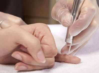 Effectuer une thérapie au laser